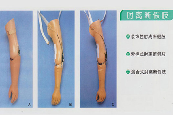 肘关节假肢