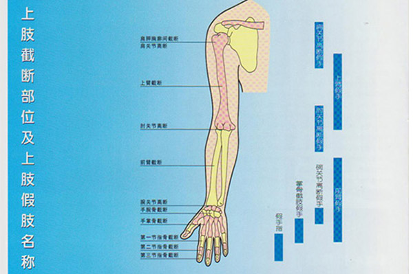 <b>上肢截断部位及名称</b>